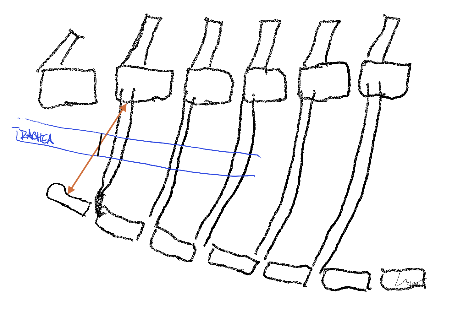 NL11-trachea.png